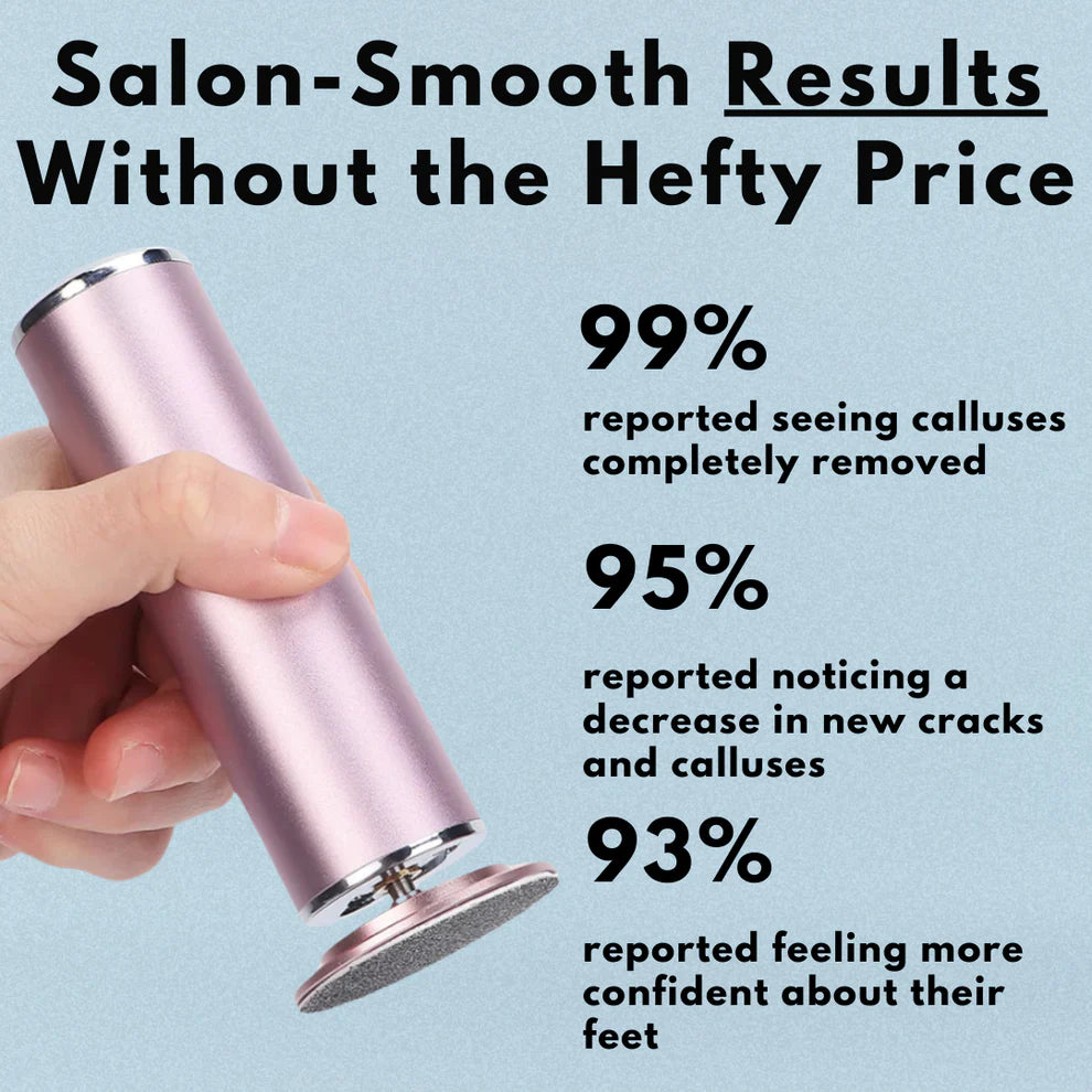 SilkSole™ | Electric Callus Remover