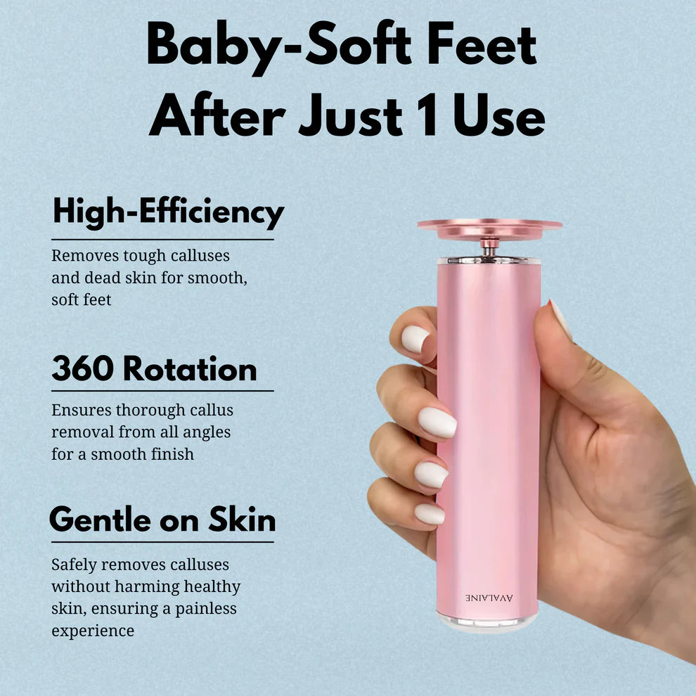 SilkSole™ | Electric Callus Remover