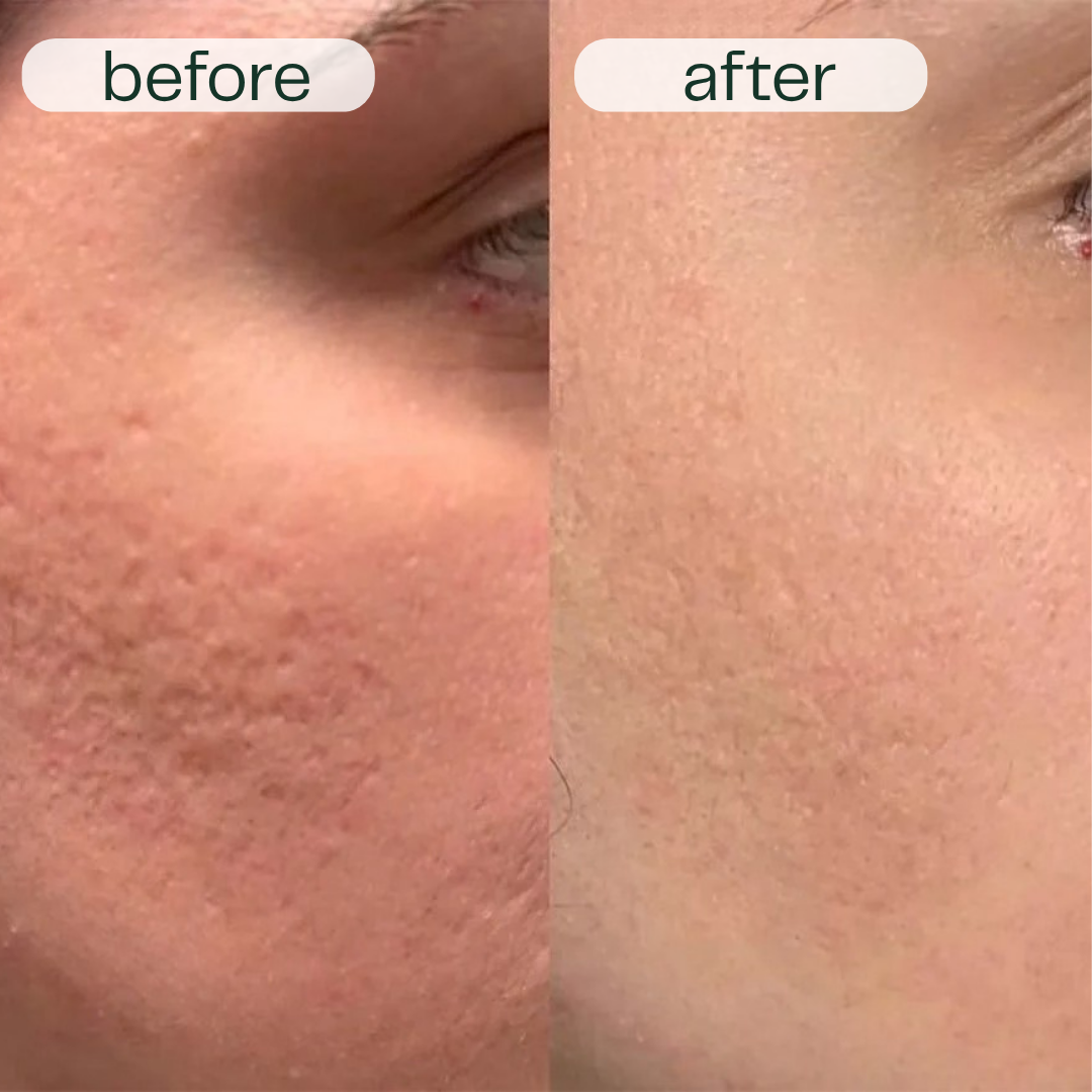 Before and after