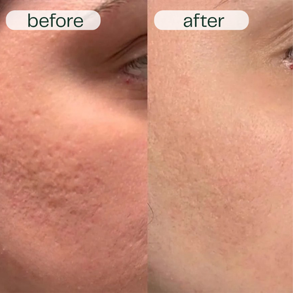 Before and after