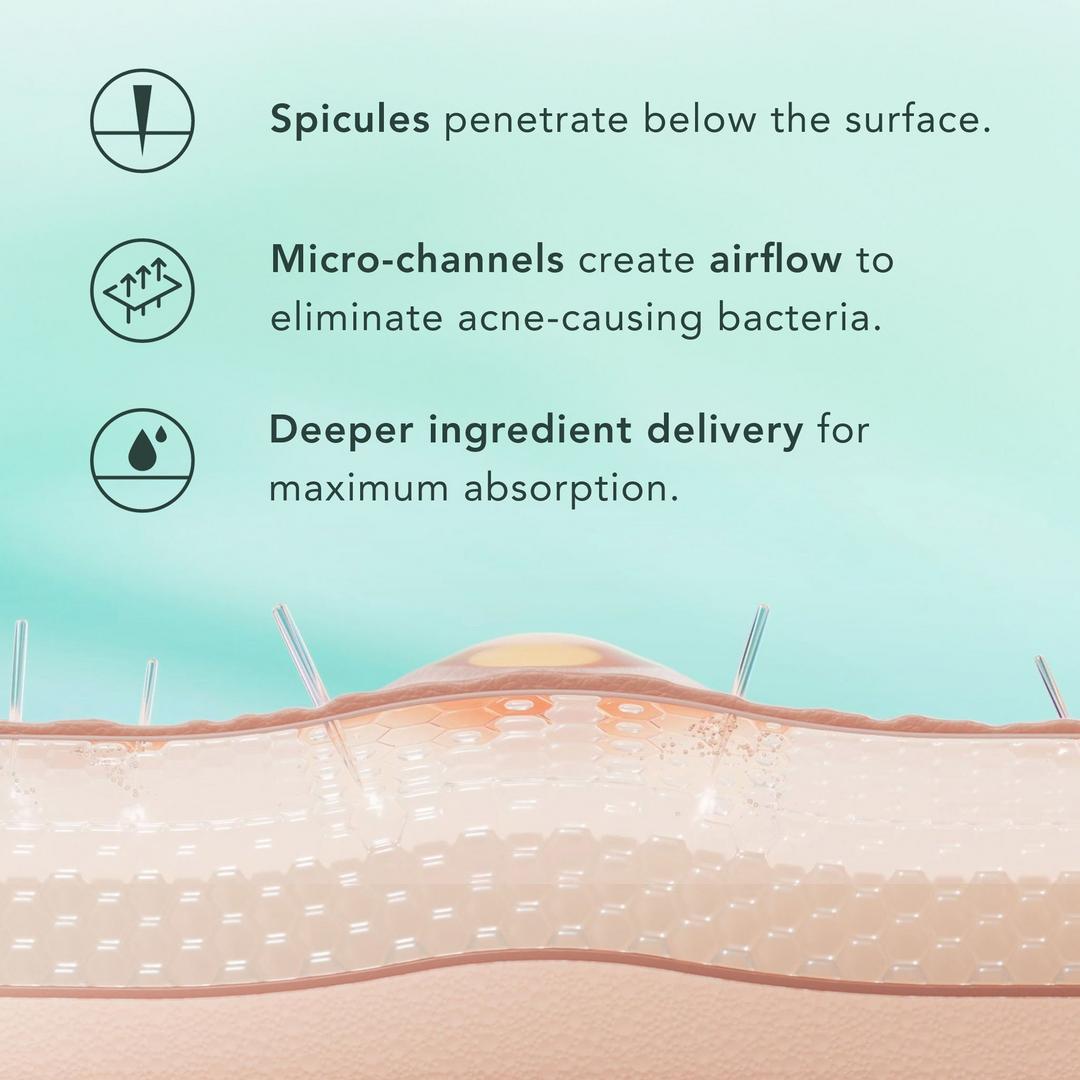 How spicules work