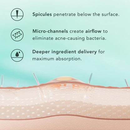 How spicules work