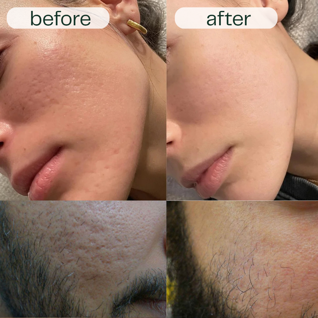 Before and after