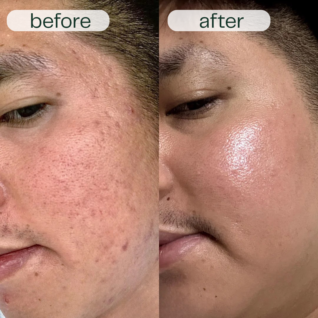 Before and after