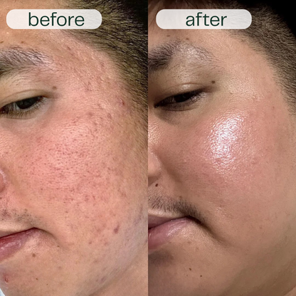 Before and after