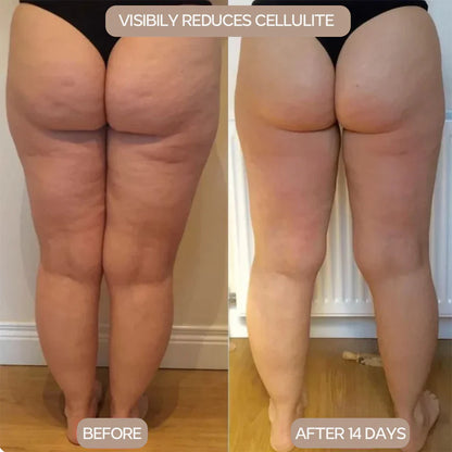 2-in-1 Deep Tissue Massage Roller